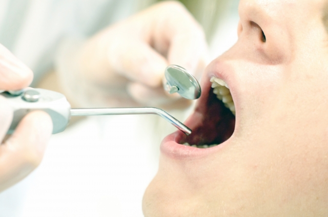 一般歯科（虫歯治療）の画像