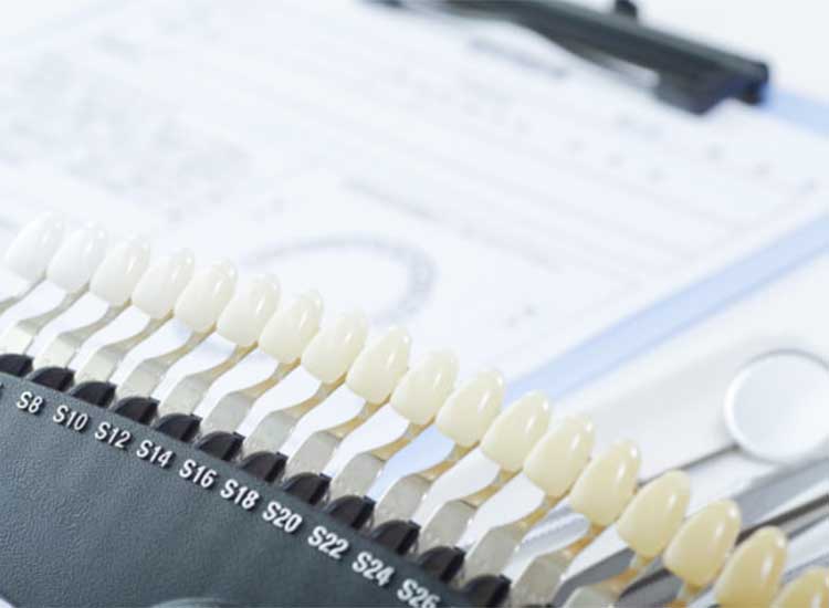 ホワイトニング